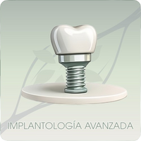 CLÍNICA DENTAL INÉS IRANZO-IMPLANTOLOGÍA AVANZADA
